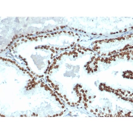 Immunohistochemistry - Anti-Androgen Receptor Antibody [DHTR/4445R] (A249057) - Antibodies.com