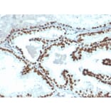 Immunohistochemistry - Anti-Androgen Receptor Antibody [DHTR/4445R] (A249057) - Antibodies.com
