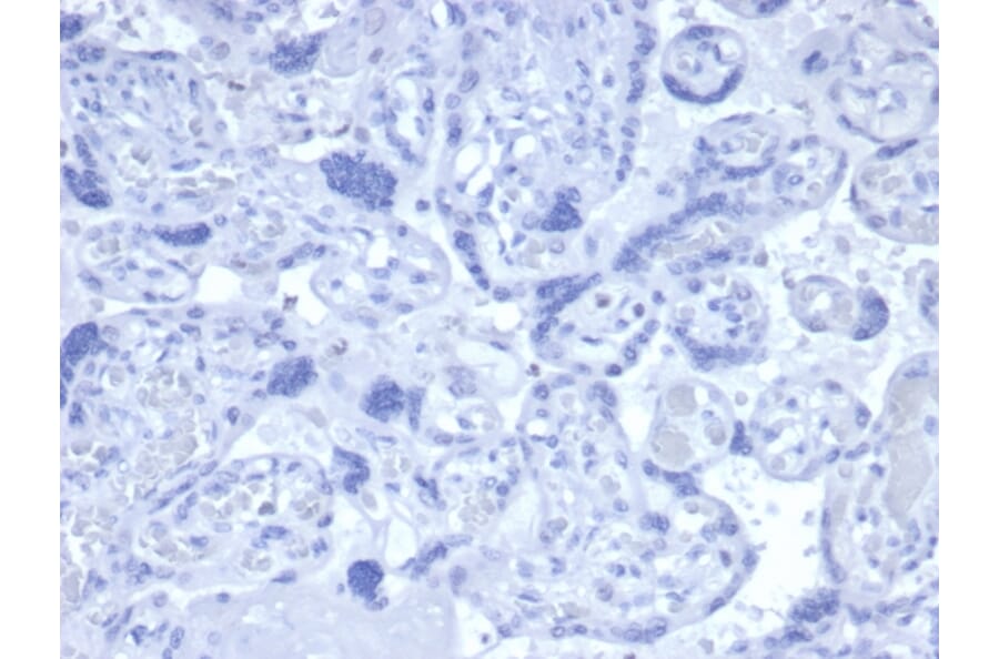 Immunohistochemistry - Anti-Androgen Receptor Antibody [DHTR/4445R] (A249056) - Antibodies.com