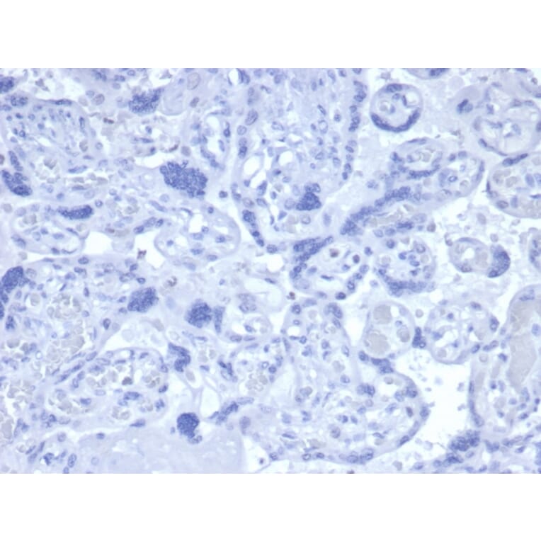 Immunohistochemistry - Anti-Androgen Receptor Antibody [DHTR/4445R] (A249056) - Antibodies.com