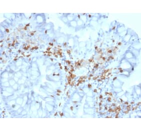 Immunohistochemistry - Anti-Integrin alpha E Antibody [ITGAE/2063] (A249058) - Antibodies.com