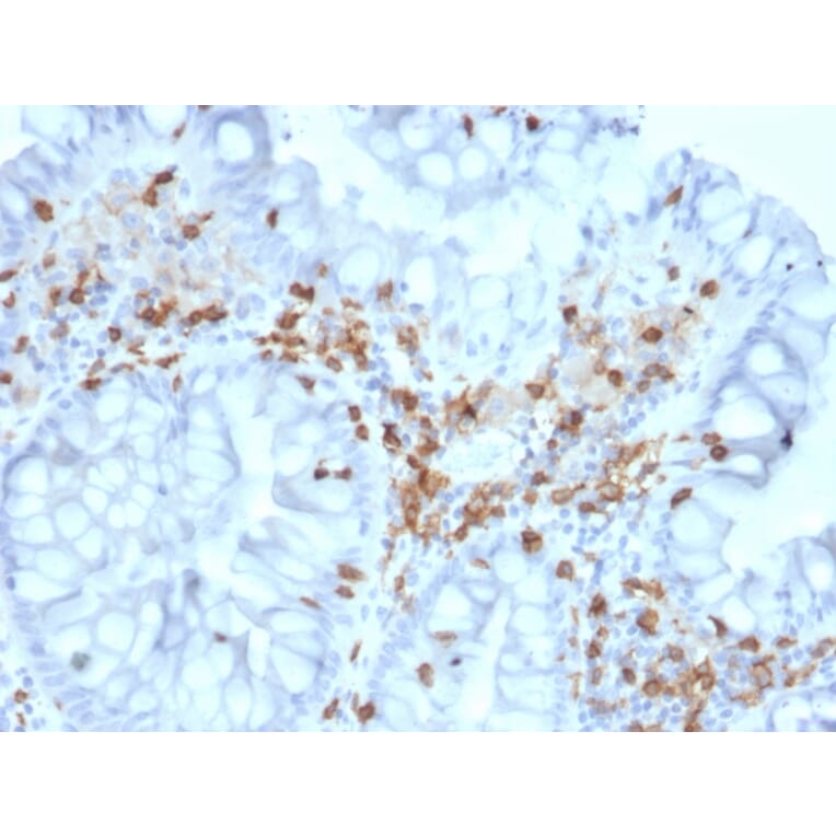 Immunohistochemistry - Anti-Integrin alpha E Antibody [ITGAE/2063] (A249058) - Antibodies.com