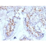 Immunohistochemistry - Anti-Integrin alpha E Antibody [ITGAE/2063] (A249058) - Antibodies.com