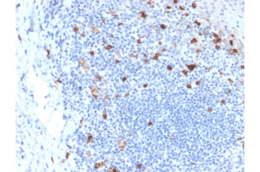 Immunohistochemistry - Anti-Integrin alpha E Antibody [ITGAE/2063] (A249058) - Antibodies.com