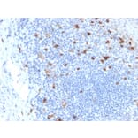 Immunohistochemistry - Anti-Integrin alpha E Antibody [ITGAE/2063] (A249058) - Antibodies.com