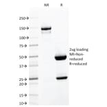 SDS-PAGE - Anti-Integrin alpha E Antibody [ITGAE/2063] (A249058) - Antibodies.com