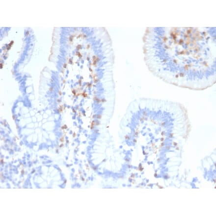 Immunohistochemistry - Anti-Integrin alpha E Antibody [ITGAE/2474] (A249059) - Antibodies.com