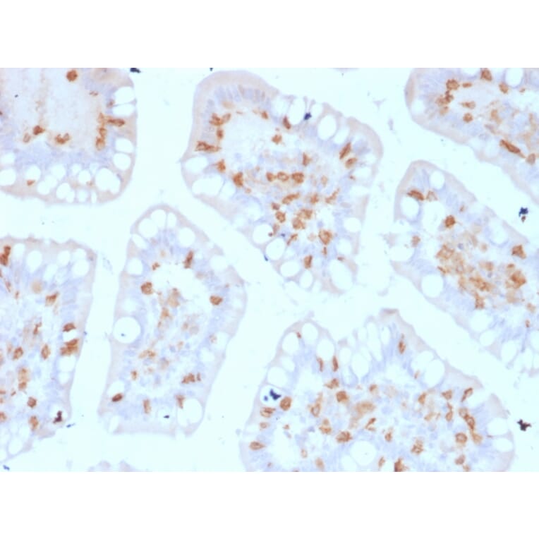 Immunohistochemistry - Anti-Integrin alpha E Antibody [ITGAE/2474] (A249059) - Antibodies.com