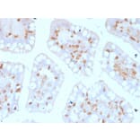 Immunohistochemistry - Anti-Integrin alpha E Antibody [ITGAE/2474] (A249059) - Antibodies.com