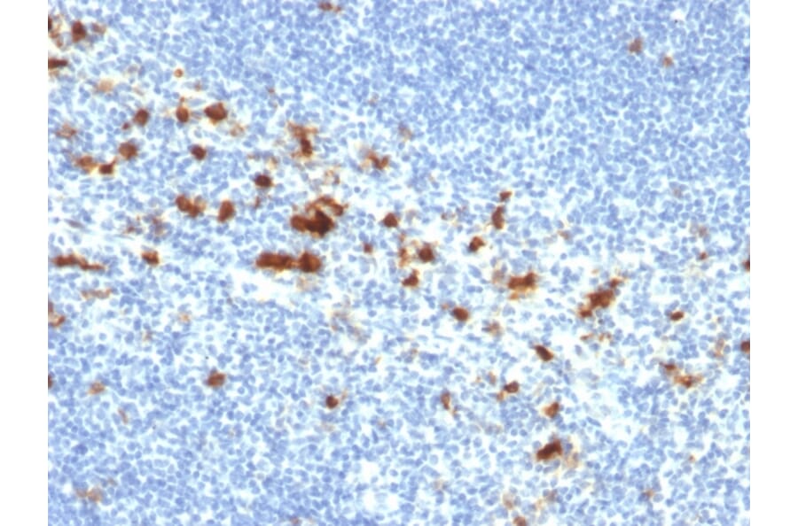 Immunohistochemistry - Anti-Integrin alpha E Antibody [ITGAE/2474] (A249059) - Antibodies.com