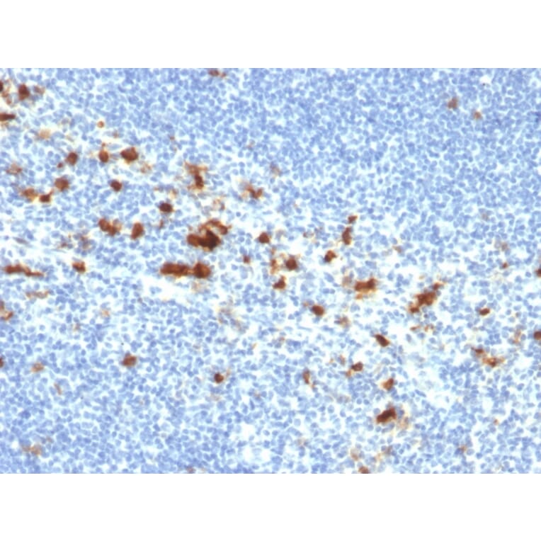Immunohistochemistry - Anti-Integrin alpha E Antibody [ITGAE/2474] (A249059) - Antibodies.com