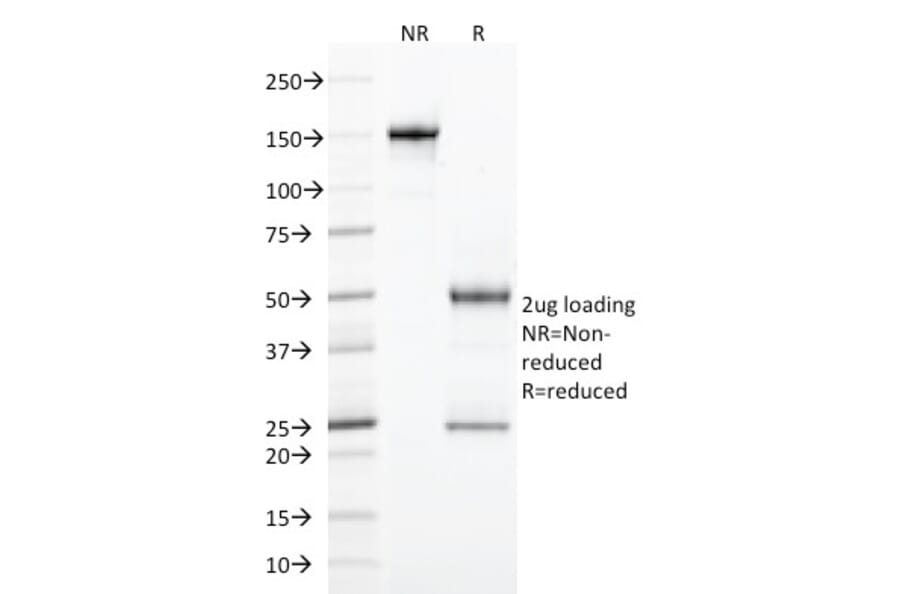 SDS-PAGE - Anti-Integrin alpha E Antibody [ITGAE/2474] (A249059) - Antibodies.com