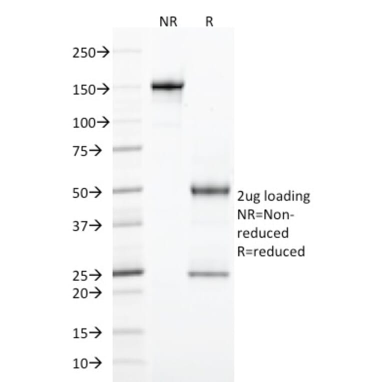 SDS-PAGE - Anti-Integrin alpha E Antibody [ITGAE/2474] (A249059) - Antibodies.com