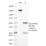 SDS-PAGE - Anti-Integrin alpha E Antibody [ITGAE/2474] (A249059) - Antibodies.com