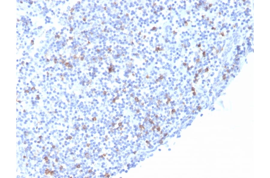 Immunohistochemistry - Anti-Integrin alpha E Antibody [rITGAE/2063] (A249059) - Antibodies.com