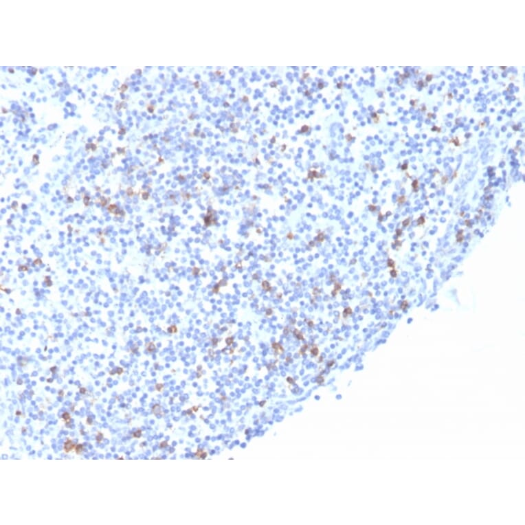 Immunohistochemistry - Anti-Integrin alpha E Antibody [rITGAE/2063] (A249059) - Antibodies.com