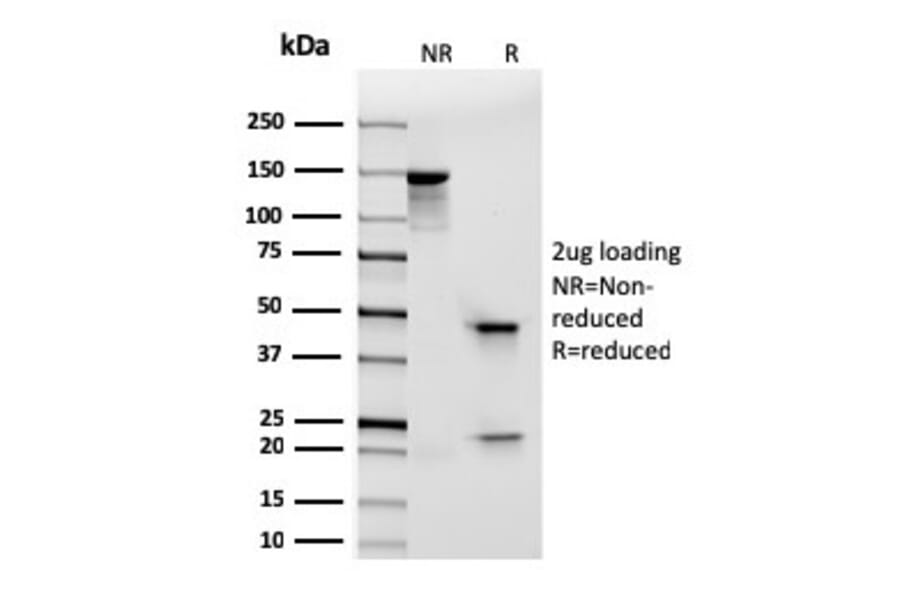 SDS-PAGE - Anti-Integrin alpha E Antibody [rITGAE/2063] (A249060) - Antibodies.com