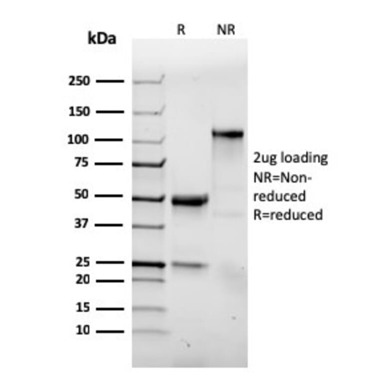 SDS-PAGE - Anti-Integrin alpha E Antibody [ITGAE/3904R] (A249061) - Antibodies.com
