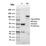 SDS-PAGE - Anti-Integrin alpha E Antibody [ITGAE/3904R] (A249061) - Antibodies.com