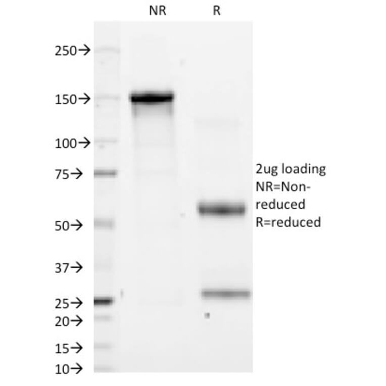 SDS-PAGE - Anti-CD11a Antibody [CRIS-3] (A249062) - Antibodies.com