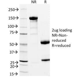 SDS-PAGE - Anti-CD11a Antibody [DF1524] (A249062) - Antibodies.com