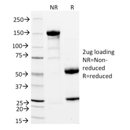 SDS-PAGE - Anti-CD11a Antibody [DF1524] (A249062) - Antibodies.com