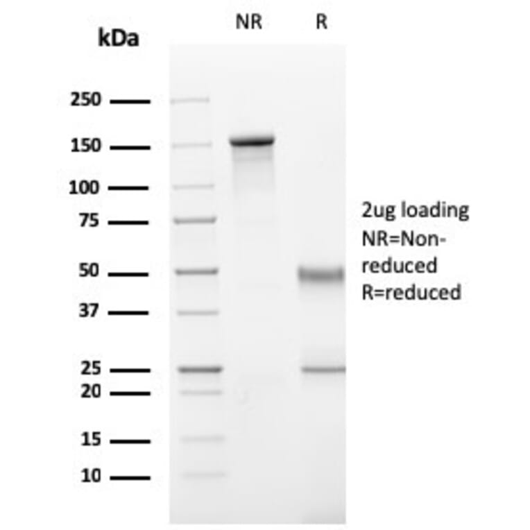 SDS-PAGE - Anti-CD11b Antibody [ITGAM/3340] (A249064) - Antibodies.com
