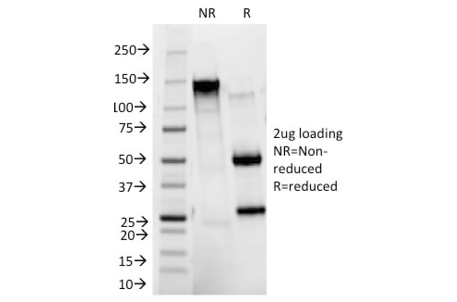 SDS-PAGE - Anti-CD11b Antibody [ITGAM/271] (A249064) - Antibodies.com
