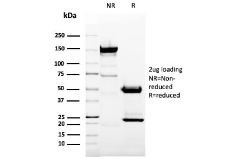 SDS-PAGE - Anti-CD11b Antibody [ITGAM/3337] (A249066) - Antibodies.com