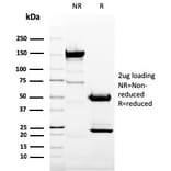 SDS-PAGE - Anti-CD11b Antibody [ITGAM/3337] (A249066) - Antibodies.com