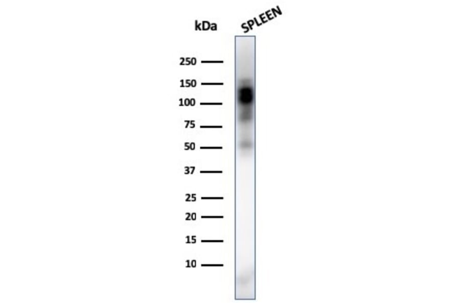 Western Blot - Anti-CD11b Antibody [ITGAM/3338] (A249067) - Antibodies.com