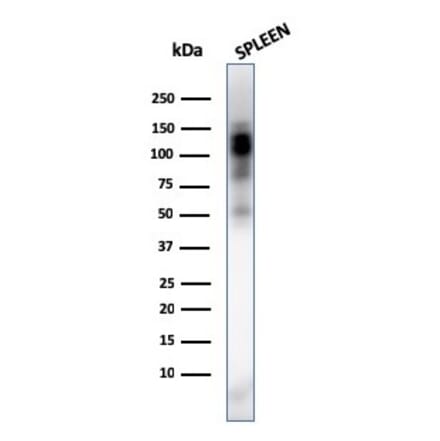 Western Blot - Anti-CD11b Antibody [ITGAM/3338] (A249067) - Antibodies.com