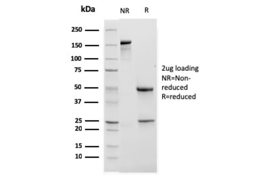 SDS-PAGE - Anti-CD11b Antibody [ITGAM/3338] (A249067) - Antibodies.com