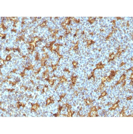 Immunohistochemistry - Anti-CD11c Antibody [ITGAX/1242] (A249072) - Antibodies.com