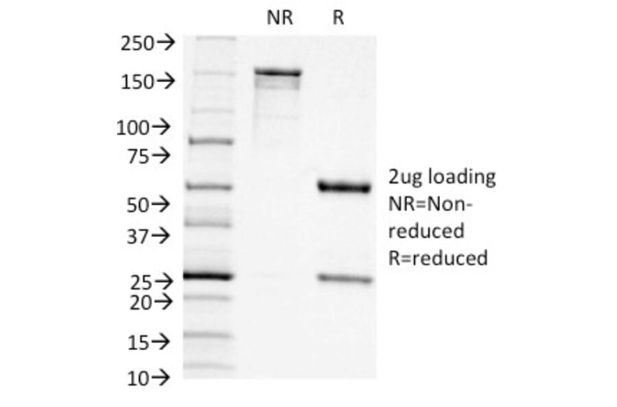 SDS-PAGE - Anti-CD11c Antibody [ITGAX/1242] (A249072) - Antibodies.com