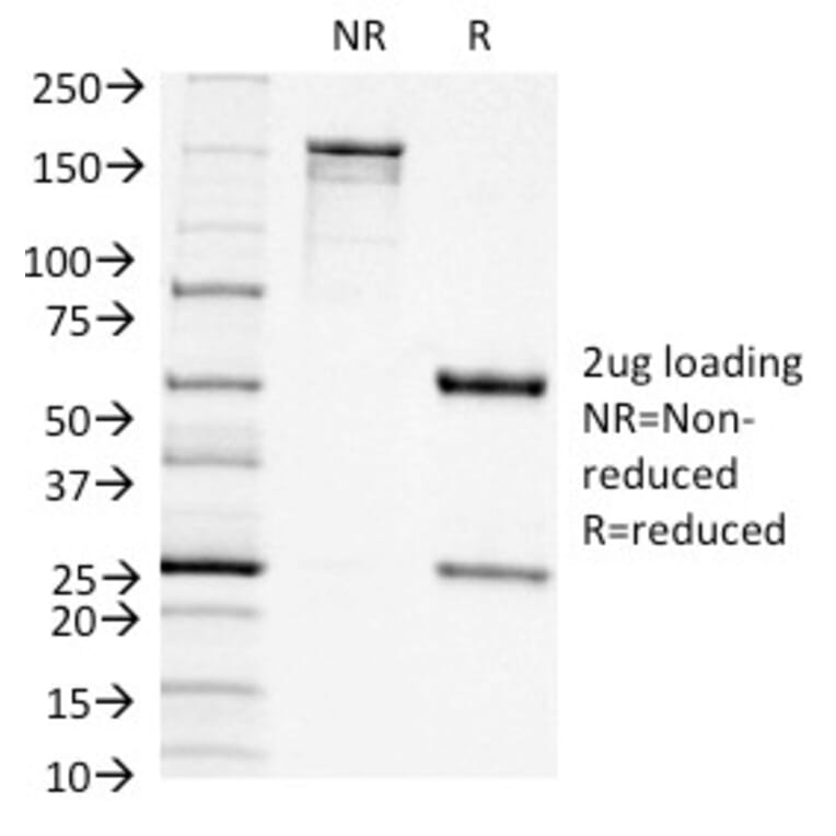 SDS-PAGE - Anti-CD11c Antibody [ITGAX/1242] (A249072) - Antibodies.com