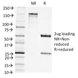 SDS-PAGE - Anti-CD11c Antibody [ITGAX/1242] (A249072) - Antibodies.com
