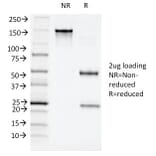 SDS-PAGE - Anti-CD11c Antibody [ITGAX/1243] (A249073) - Antibodies.com