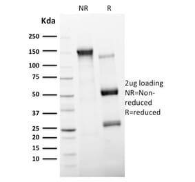 SDS-PAGE - Anti-CD11c Antibody [ITGAX/2507] (A249075) - Antibodies.com