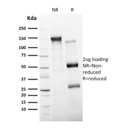 SDS-PAGE - Anti-CD11c Antibody [ITGAX/2507] (A249075) - Antibodies.com