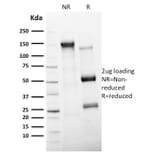 SDS-PAGE - Anti-CD11c Antibody [ITGAX/2507] (A249075) - Antibodies.com