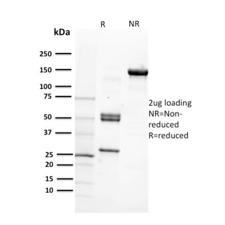 SDS-PAGE - Anti-CD29 Antibody [12G10] (A249075) - Antibodies.com
