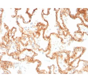 Immunohistochemistry - Anti-CD29 Antibody [ITGB1/3613] (A249077) - Antibodies.com