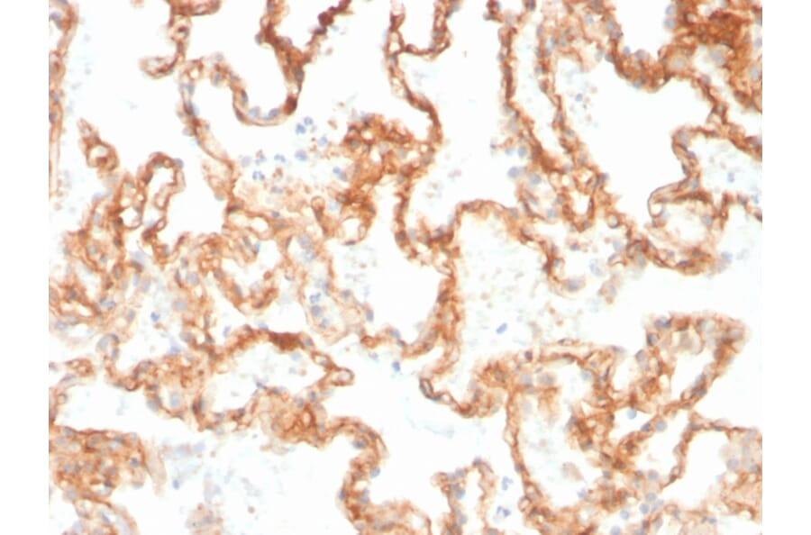 Immunohistochemistry - Anti-CD29 Antibody [ITGB1/3613] (A249077) - Antibodies.com