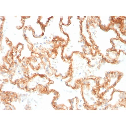 Immunohistochemistry - Anti-CD29 Antibody [ITGB1/3613] (A249077) - Antibodies.com