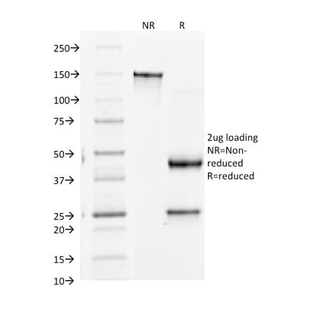 SDS-PAGE - Anti-Integrin beta 3 Antibody [Y2/51] (A249079) - Antibodies.com