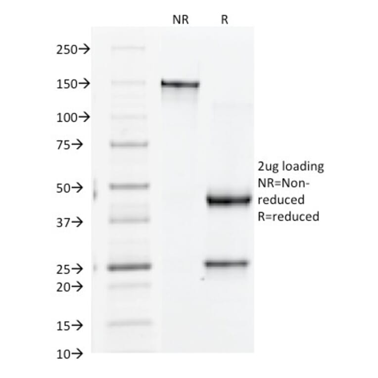 SDS-PAGE - Anti-Integrin beta 3 Antibody [Y2/51] (A249079) - Antibodies.com