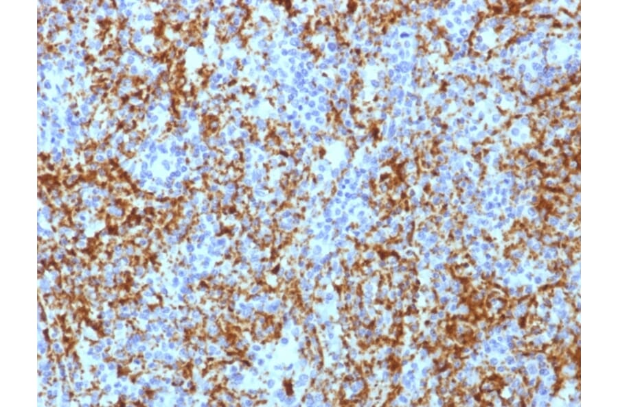 Immunohistochemistry - Anti-Integrin beta 3 Antibody [ITGB3/1713] (A249079) - Antibodies.com