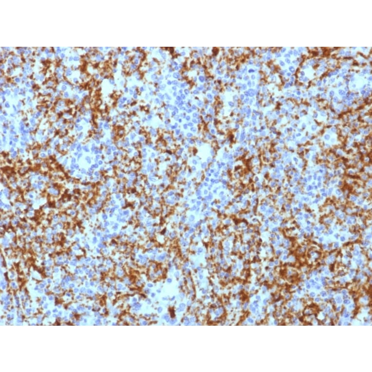 Immunohistochemistry - Anti-Integrin beta 3 Antibody [ITGB3/1713] (A249079) - Antibodies.com