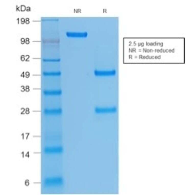 SDS-PAGE - Anti-Integrin beta 3 Antibody [rITGB3/1713] (A249081) - Antibodies.com